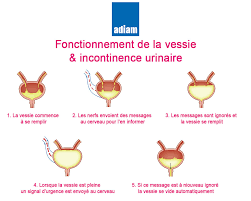 Une forme sensorielle et une forme motrice. Incontinence Urinaire Traitement Symptome Et Aide A Domicile Paris