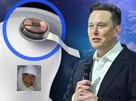 Neuralink Brain Chip: जानिए इंसान कैसे बनेगा Superhuman? 🧠🤖