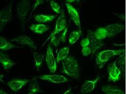 Image result for ANA Staining Pattern