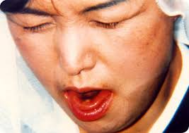 12) August 24, 1995, The Eucharistic miracle occurred during Mass with  Bishop Su, Malaysia, in the Blessed Mother's mountain : Eucharistic Miracles