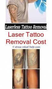 Can Makeup Remover Damage Tattoo Why Get A Tattoo Removed Tattoo Removal Cream Reviews Uk Tattoo Remo Tattoo Removal Cost Tattoo Removal Cream Tattoo Removal