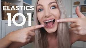If that didn't work then i had to get a braces. Elastics Rubber Bands 101 Everything You Need To Know Youtube