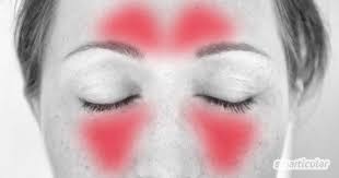 Nasennebenhohlenentzundung Sinusitis Naturlich Behandeln Mit Ingwer Rotlicht Zwiebel