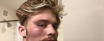 Antifa Activist Assaults Pro-Lifer