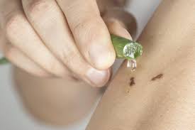 Anda punya banyak tanaman lidah buaya di depan rumah? Aloe Vera Benefits And Medical Uses