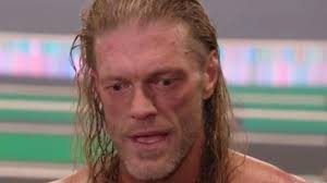 Edge Talks About Infamous Segment From His Past Potentially Being Kept Off  Of Peacock Platform