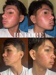 Bumanlag Skin Center formerly Derma by Dr. Aileen Johanna C. Bumanlag