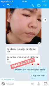 Kem Dưỡng trắng Da Hồng Sâm My Gold Hàn Quốc