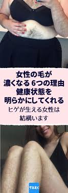 ボード アンチエイジング のピン