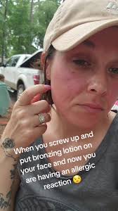 my face is too sensitive for this 🙄 my luck 🤣 #allergic #allergicreaction  #roadto10k #itchy #swollen