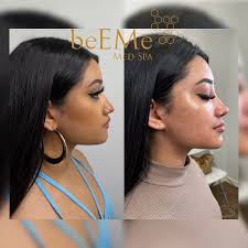 Houston Body Contouring