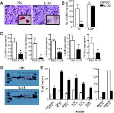 Interleukin-33 Induces Protective Effects in Adipose Tissue Inflammation  During Obesity in Mice