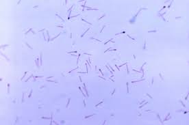 Image result for Clostridium