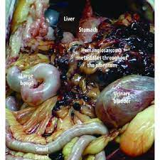 Some of the signs that it's time to say goodbye to a dog with cancer include: Metastatic Hemangiosarcoma Throughout The Omentum At Necropsy Of A Dog Download Scientific Diagram