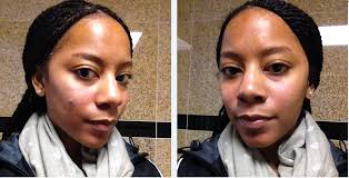 My First Chemical Peel Review with Pictures- Mocha Girls Pit Stop