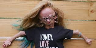 Is Adalia Rose Alive A Closer Look At Adalia S Condition And Her Parents Thenetline