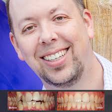 JEREMIAH & MELODY Before and After Photos Reno NV