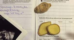 Ab wann sie damit rechnen können. Schwanger Mit Mehr Als Ein Bisschen Ubelkeit Von Guten Eltern