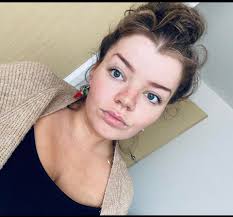 Mum reveals horror injuries after evil ex battered her with a brick as thug  caught