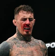 Rigged early stoppage he barley did anything how trash was that ref na what  a boring fight why would he stop it