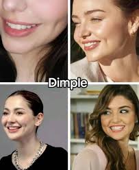 Some Girls Have All The Luck 🍀