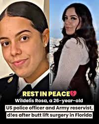 Brazilian social media influencer Adair Mendes Dutra Junior, widely known  as Junior Dutra, has died at the age of 31 following severe complications  from a cosmetic procedure. Known for his vibrant social