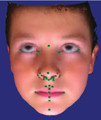 The anthropometric landmarks used in the study digitized