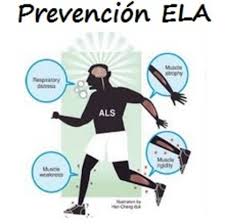 Amyotrophic lateral sclerosis is a neurodegenerative neuromuscular disease that results in the progressive loss of motor neurons that control voluntary muscles. Resumen De La Revision Sistematica De Wang Md Y Cols Sobre Los Factores De Riesgo De Ela