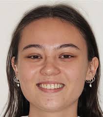 Book Your Orthodontic Consultation