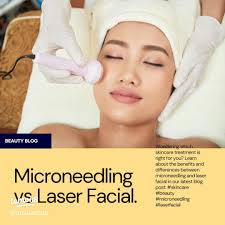 Microneedling vs Laser: Which is Best for Your Skin in Singapore?