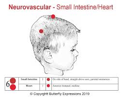 17 tcm headaches 6 small intestine heart