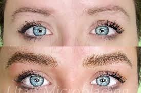 Instant korea bb glow laser treatment. Top 3 Aesthetic Medicine Near You In South Jordan Ut Find The Best Aesthetic Medicine For You