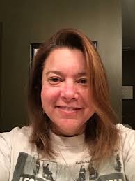 Does anyone have experience with hair loss. I am a 52 year old female and  my hair line is receding, especially