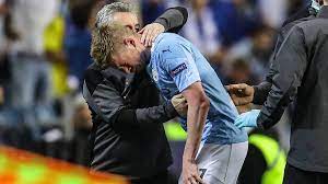 Последние твиты от antonio rüdiger (@toniruediger). Zusammenprall Mit Rudiger Mancity Star Kevin De Bruyne Erleidet Knochenbruche Im Gesicht Sportbuzzer De