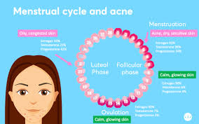 An excess of androgens (male hormones that both men and women have) can cause. Hormonal Acne Best Treatment According To Dermatologists Mdacne