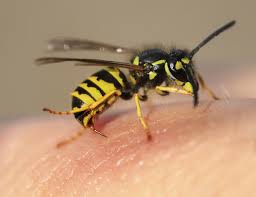 Erste Hilfe Nach Wespen Oder Bienenstich Das Kannst Du Tun