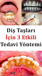 Pin On Dogal Tedaviler