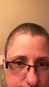 Hair loss and growth during and after chemo! Love my chemo curls, and they  love the FL humidity.#chemohairdontcare #chemohairgrowth #chemocurls