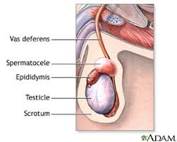 In general, there are two types of testicular cancer: Testicular Cancer Pioneer Valley Urology P C