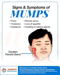 Image result for Mumps