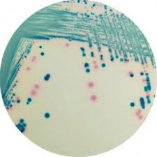 Coli (stec), can cause severe foodborne disease. Mezzo Reattivo Sc172 Sc173 25 Chromagar Microbiologico Per Campioni Di Urina Per Campioni Di Feci