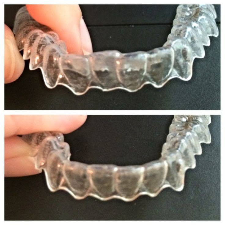 Invisalign Comprehensive Package product image