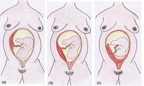 It plays critical roles in facilitating nutrient, gas and waste exchange between the physically separate maternal and fetal circulations. Olcreate Heat Anc Et 1 0 Antenatal Care Module 21 Late Pregnancy Bleeding 21 3 Placenta Previa