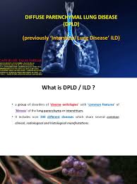 The good news is many cases of lung cancer are believed to be preventable, as an estimated 90% of lung cancer cases are caused by active smoki. Diffuse Parenchymal Lung Disease Pulmonology Epidemiology