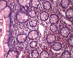 The vomiting usually starts before the diarrhoea and subsides after one or two days. How To Prevent Gastroenteritis World Economic Forum