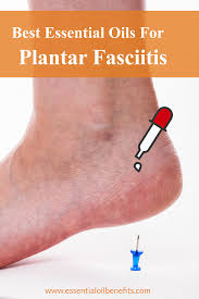Pin On Essential Oils