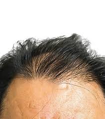 +49 (0)151 156 76 146. My Perfect Hair Clinic Qunomedical