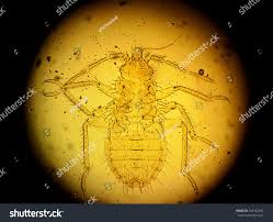 Image result for Cimex Lectularius L