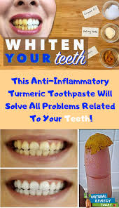 Pin On Teeth Whitening Products