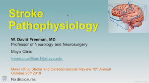 Image result for Stroke Pathophysiology
